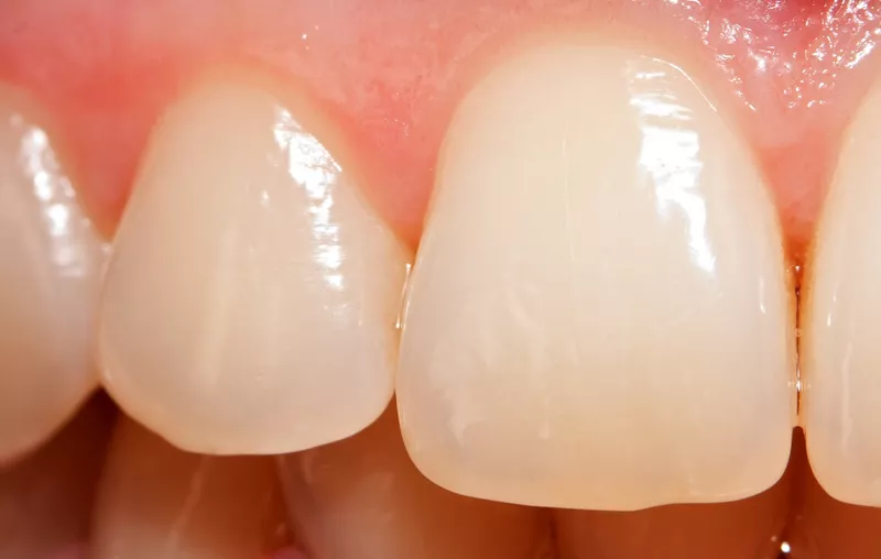 Szkliwo zęba