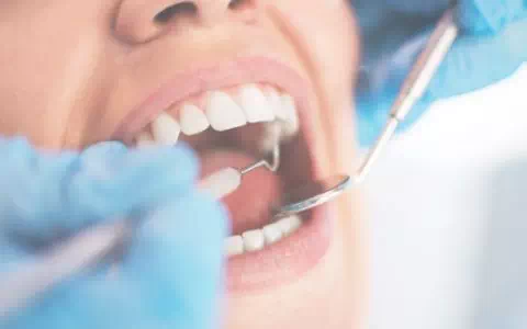 Sprawdzanie zębów